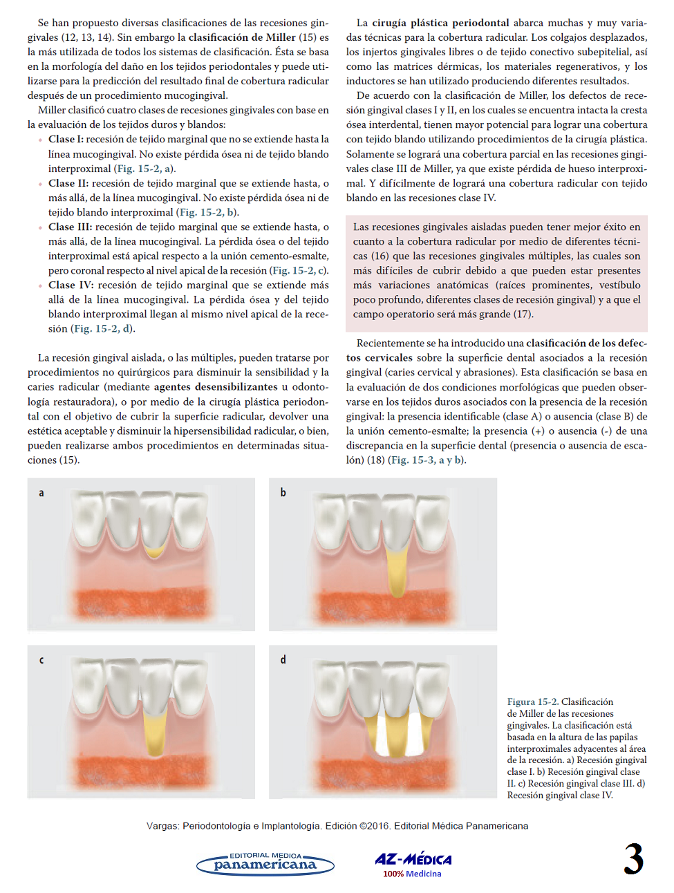 Cirugía Plástica Periodontal - Fuente:  Periodontología e Implantología - Vargas Casillas - 9786079356910